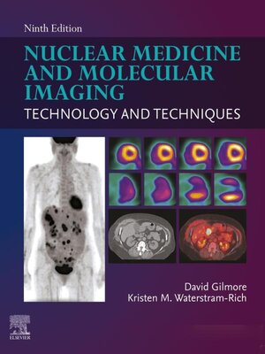 cover image of Nuclear Medicine and Molecular Imaging--E-Book